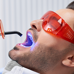 تنظيف وتبييض الأسنان