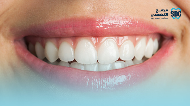 طريقة تركيب ابتسامة هوليود المتحركة.. سر الابتسامة المثالية