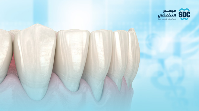 أسرار المرض الصامت: علاج انحسار اللثة