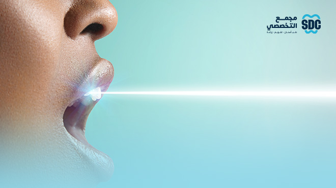 قص-اللثة-بالليزر