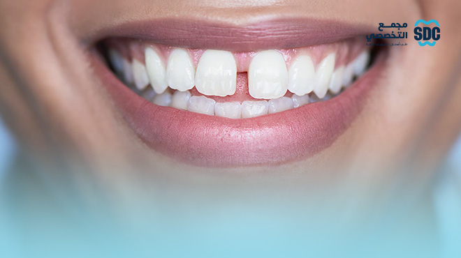 الحشوات-التجميلية