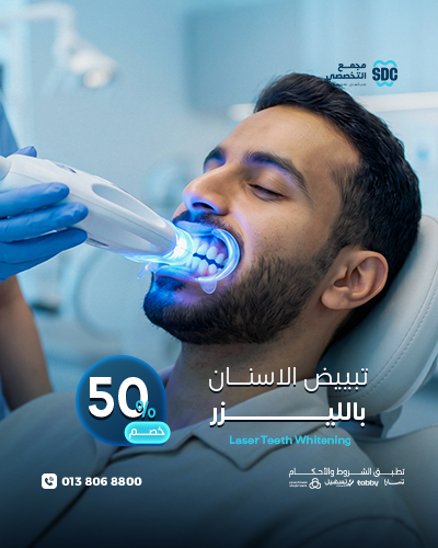 تبييض الاسنان بالليزر