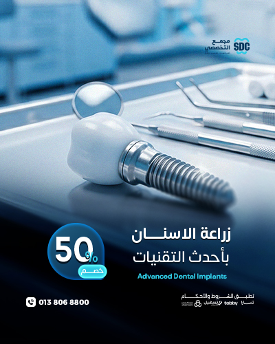زراعة الاسنان بأحدث التقنيات