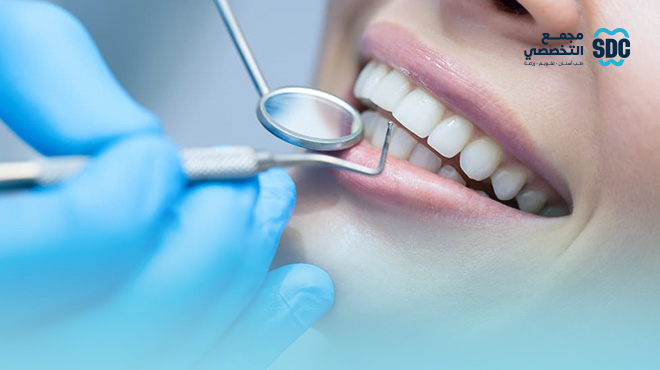 عروض-تنظيف-الاسنان-جدة