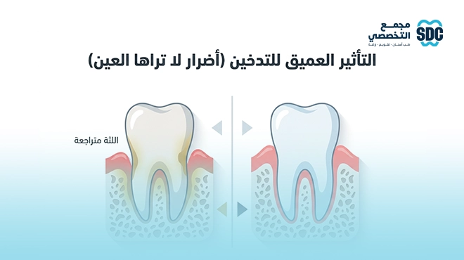 صورة-توضح-تأثير-التدخين-العميق-على-الأسنان