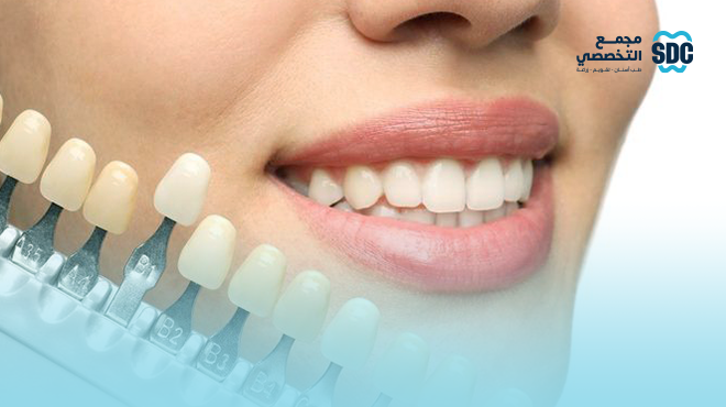 صورة-توضح-درجات-ألوان-الايماكس