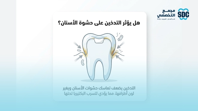 صورة-توضح-مدى-تأثير-التدخين-على-حشوة-الأسنان