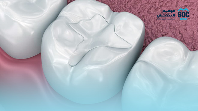 الحشوات-التجميلية-لسد-الفراغات 