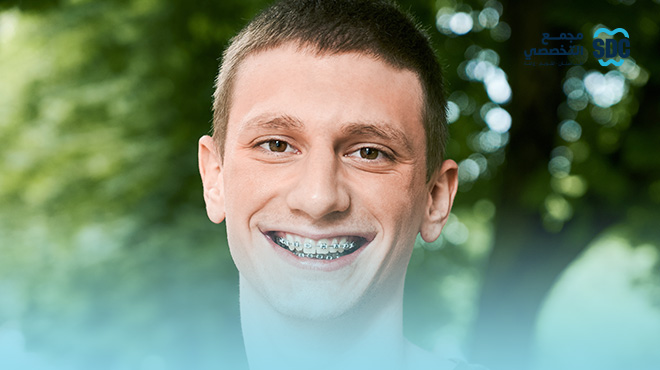 شروط-تركيب-تقويم-الأسنان