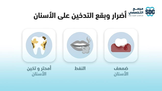 صورة-توضح-أضرار-وبقع-التدخين-على-الأسنان