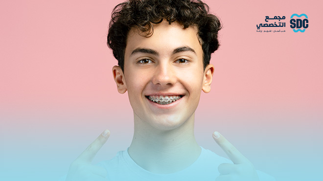شروط-تركيب-تقويم-الأسنان