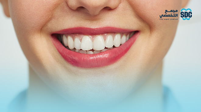 طريقة-تركيب-ابتسامة-هوليود-المتحركة طريقة-تركيب-ابتسامة-هوليود-المتحركة