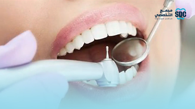 عروض-تنظيف-الاسنان-جدة