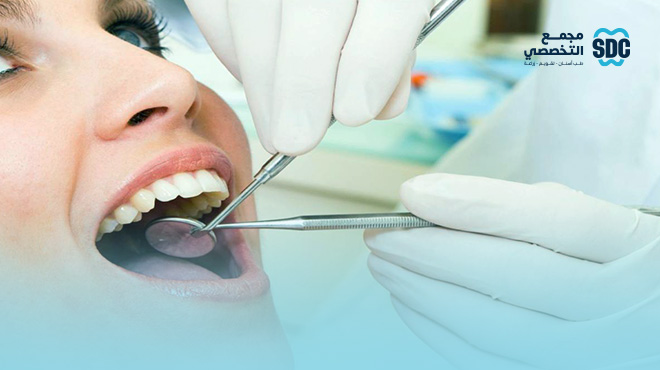 انواع-حشوات-الاسنان-وافضلها انواع-حشوات-الاسنان-وافضلها